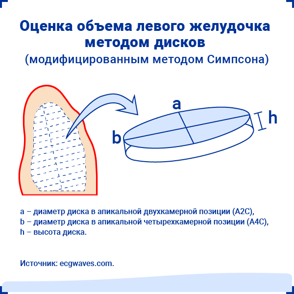 Оценка объема левого желудочка методом дисков